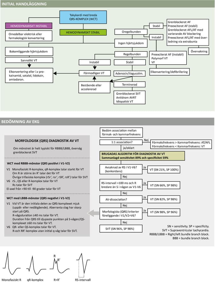 Figure 62. Diagnostik och handläggning av takyarytmi med breda QRS-komplex.