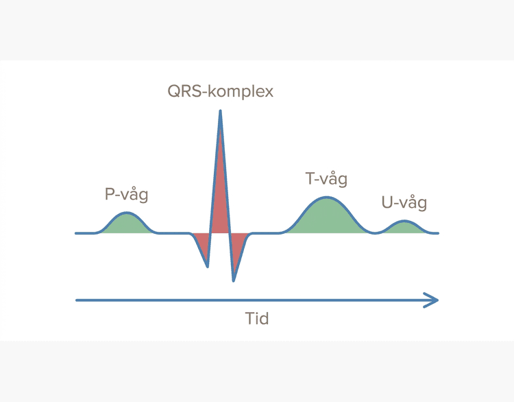 Schematisk EKG-cykel med P-våg, QRS-komplex, T-våg och U-våg.