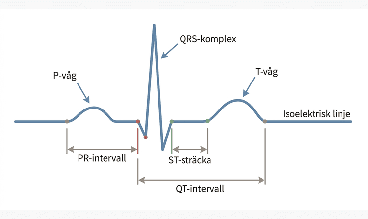 Schematisk EKG-kurva med P-våg, QRS-komplex, T-våg och centrala intervall markerade.