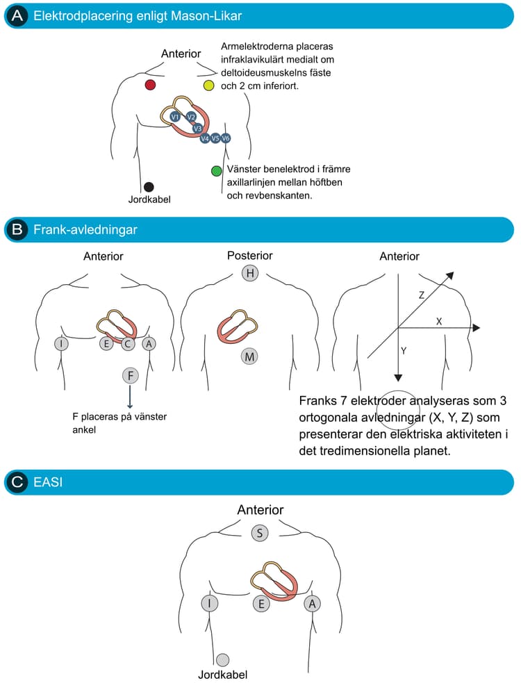Figur 18. Alternativa avledningssystem.