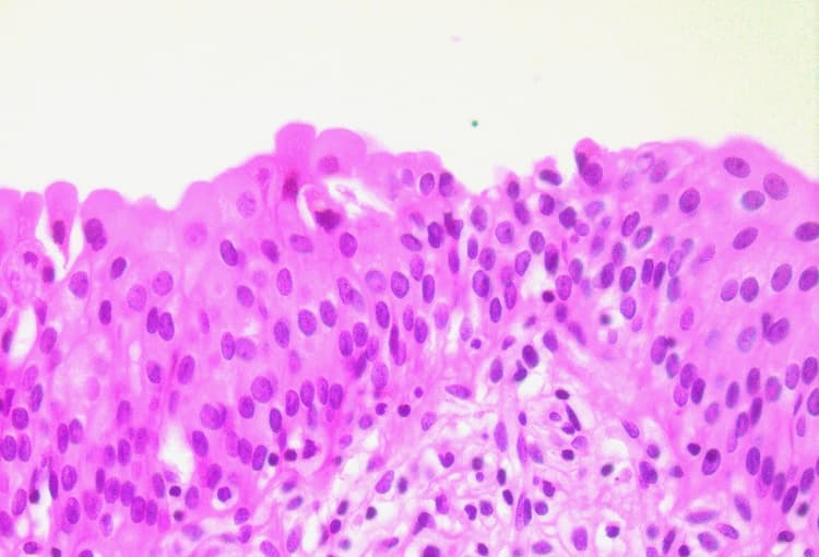 Ljusmikroskopisk bild av urinblåsans övergångsepitel med flerskiktat urothelium.