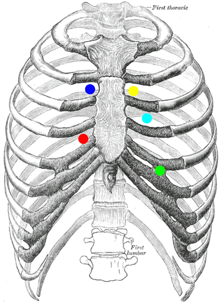 Bröstkorg med markerade auskultationsområden för aorta-, pulmonalis-, trikuspidalis- och mitralisklaff samt Erbs punkt.