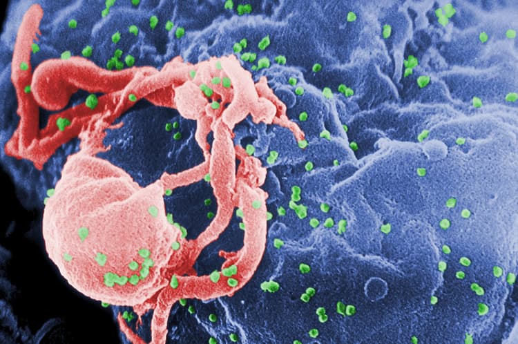 Färglagd svepelektronmikroskopisk bild av HIV-1 som knoppar av från en lymfocyt