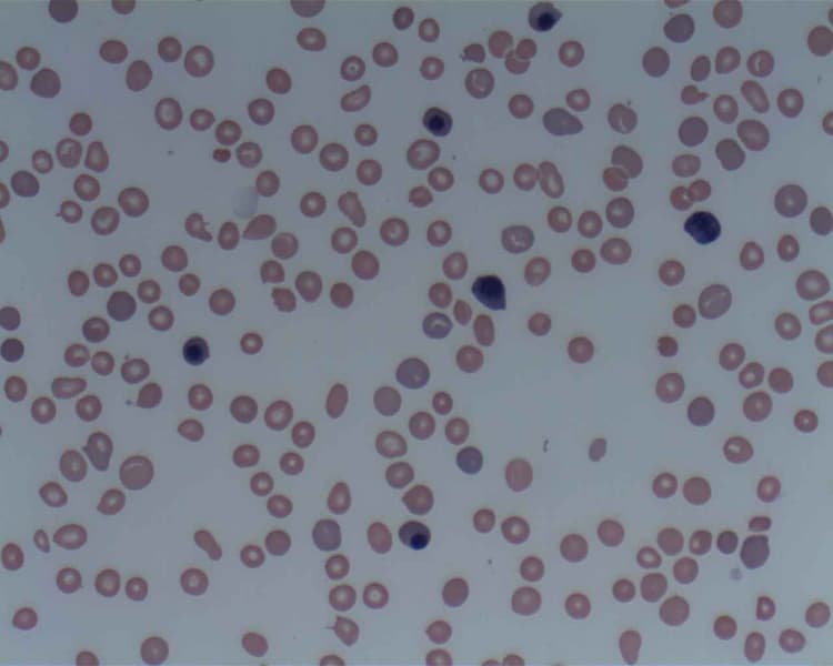 Mikroskopibild av kärnförande erytroid prekursor