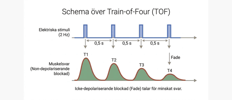 Schema över train-of-four med fyra elektriska stimuli och muskelsvar.