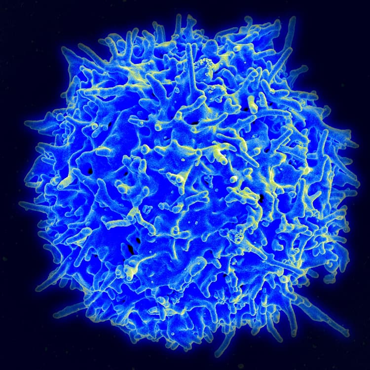 Svepelektronmikroskopisk bild av en human T-lymfocyt